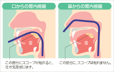 経鼻内視鏡検査の特徴1