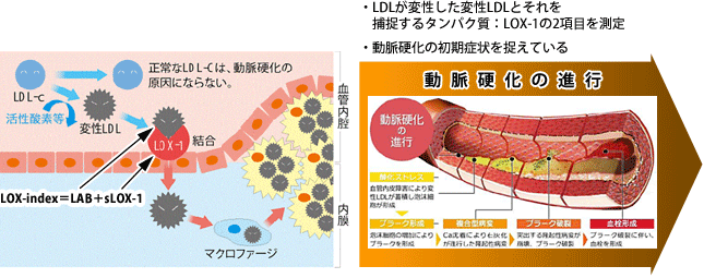 変性LDL、LOX-1とは